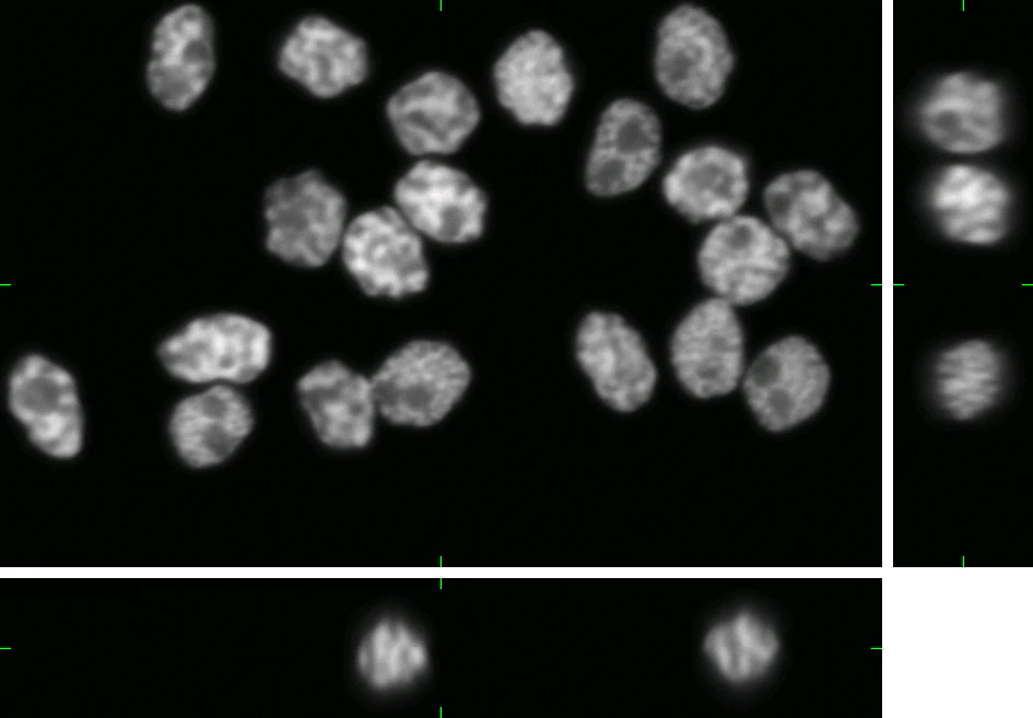 Microscopic grayscale image showing multiple cell nuclei with varied shapes and detailed internal structures on a black background.