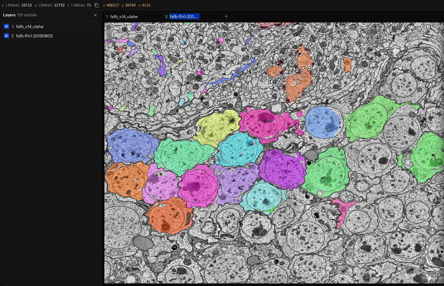 NeuroGlass with a full-screen 2D electron-microscopy view and a cell segmentation layered on top.