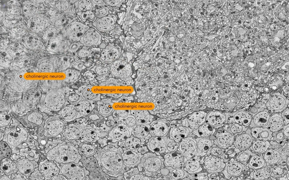 Three cells in an electron-microscopy volume marked as cholinergic neurons.